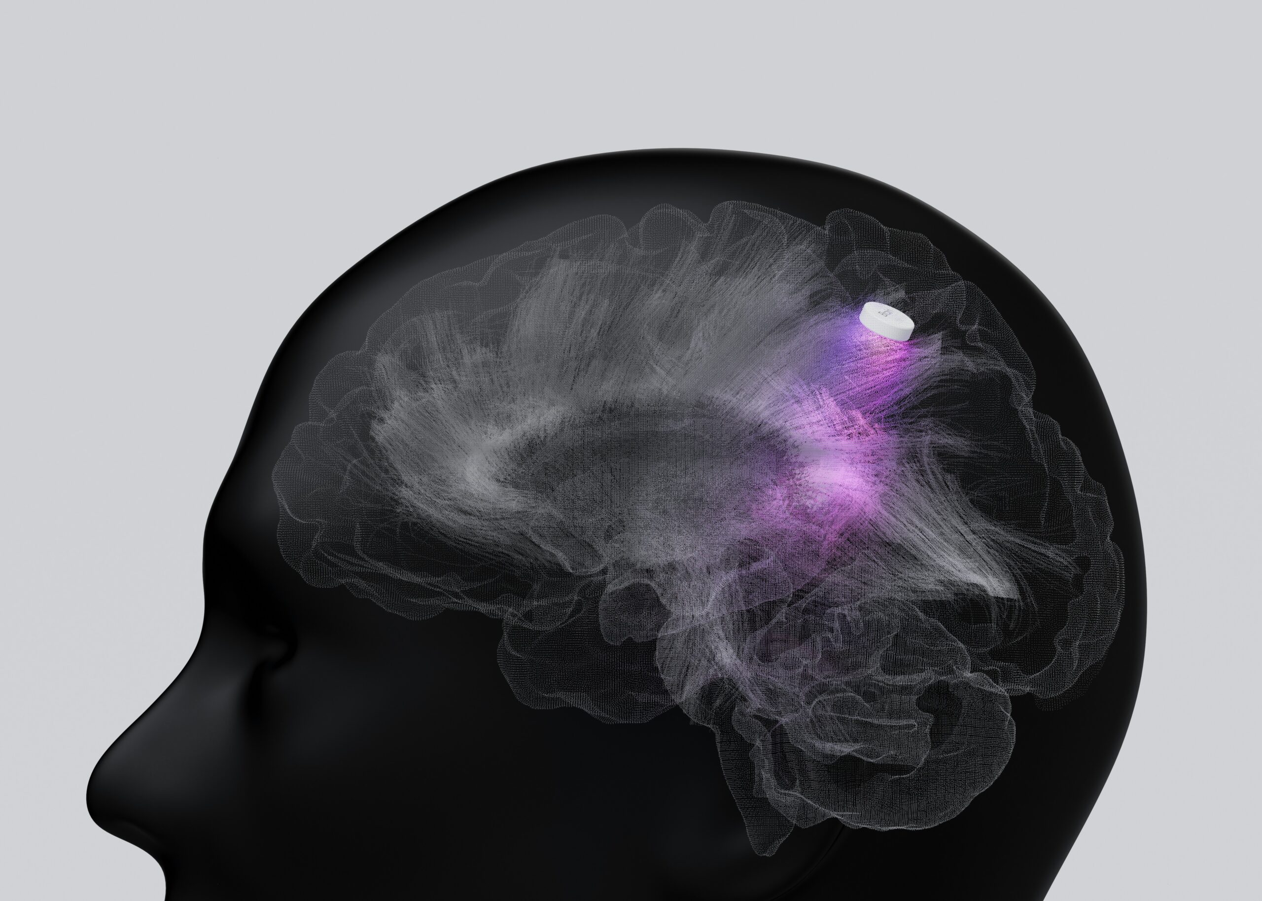 Ketamine Mechanism