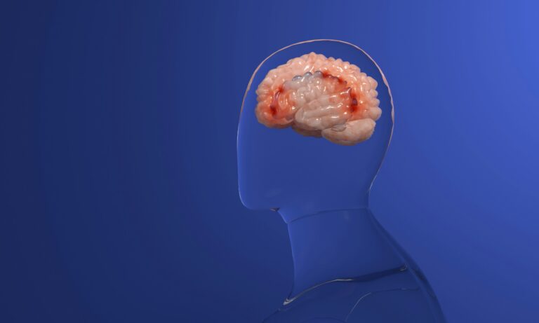 Focused Ultrasound Neuromodulation
